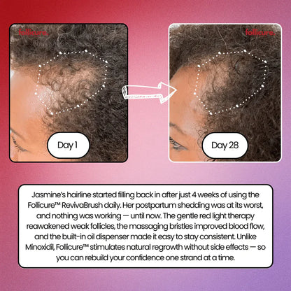 Scalpure™ VitalBrush